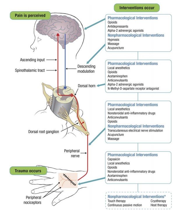 Pain pathway from surgery site to brain.